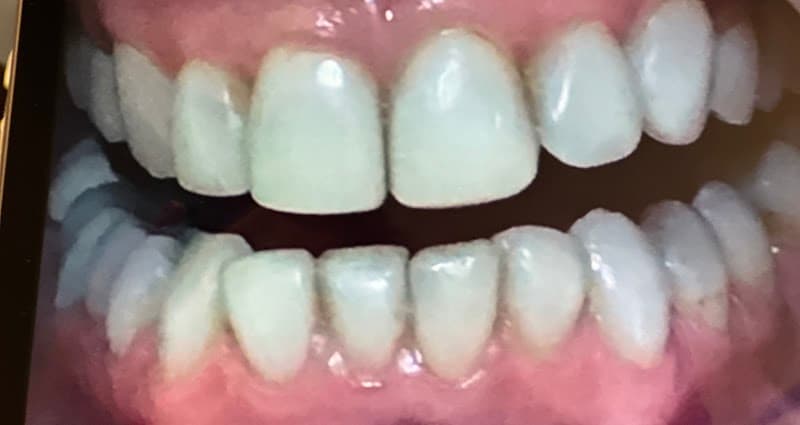 Beaumont Smiles Dental main photo