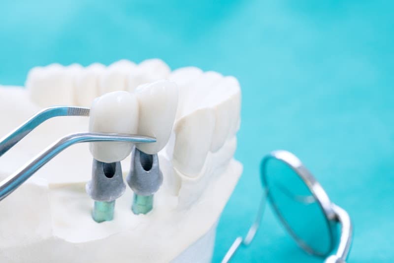 Mills Haven Dental main photo